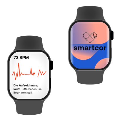Smartwatch zeigt EKG und smartcor-App