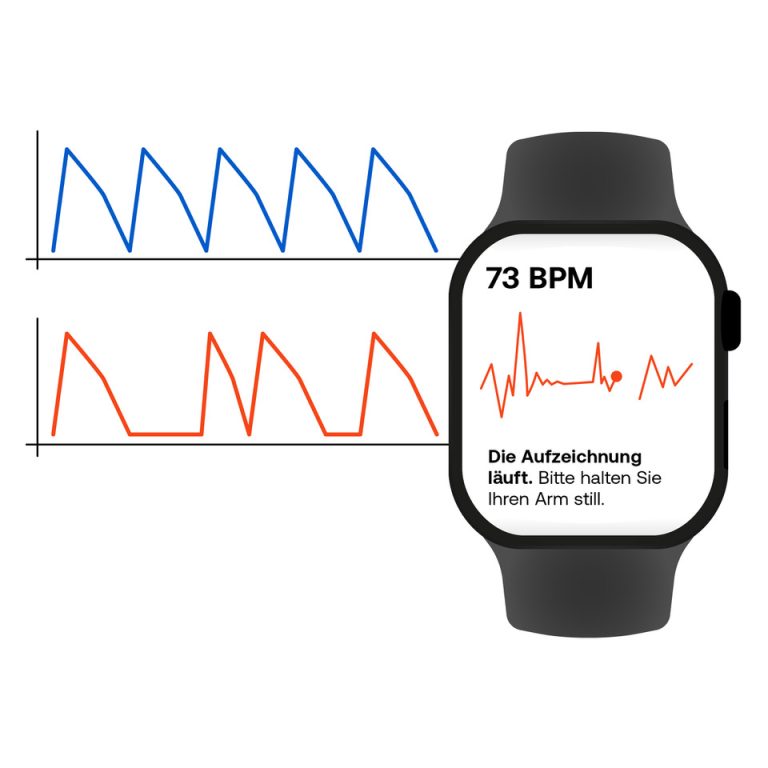 Smartwatch mit EKGFunktion smartcor