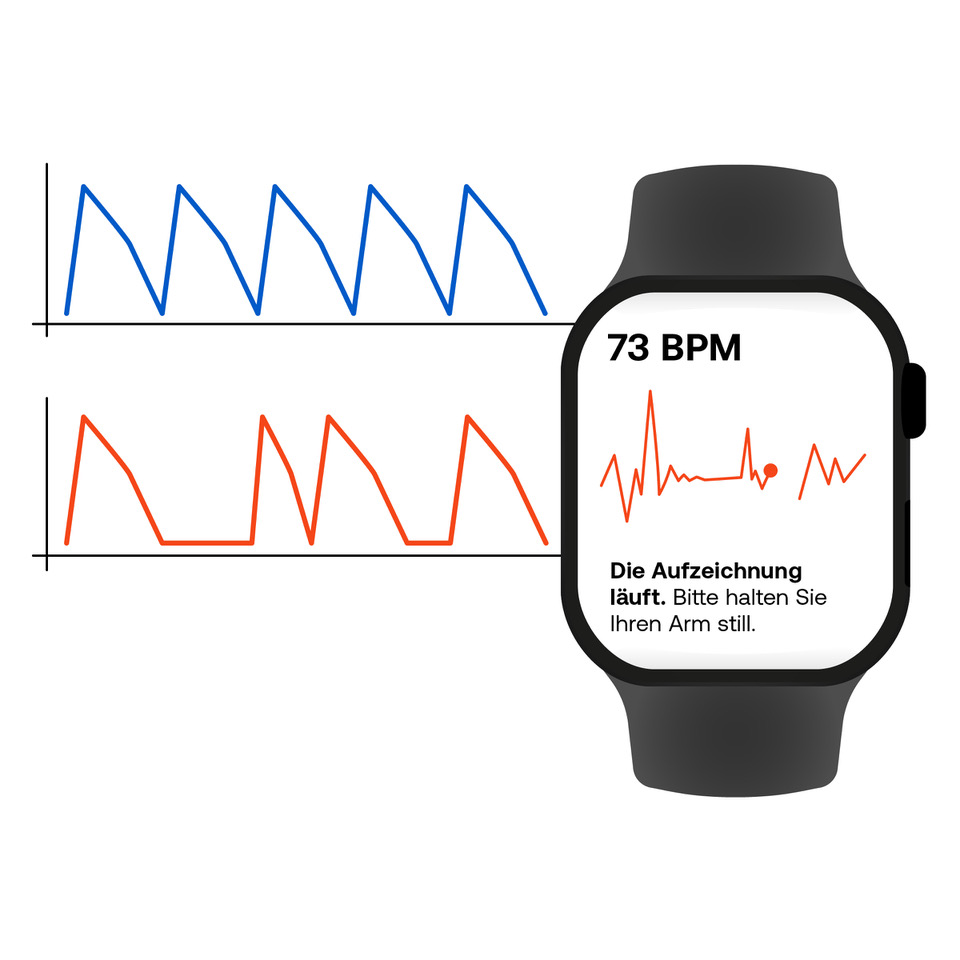 Aufzeichung eines EKGs auf einem Smartphone