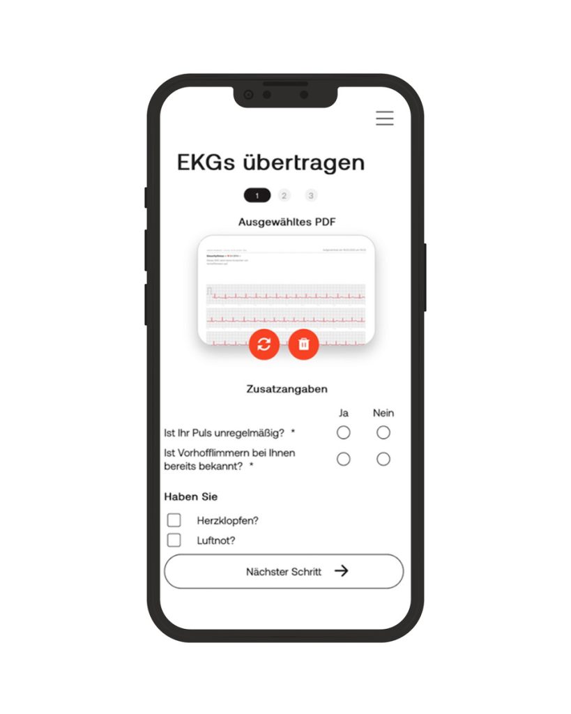 Ansicht in der App: EKG mit smartcor übertragen