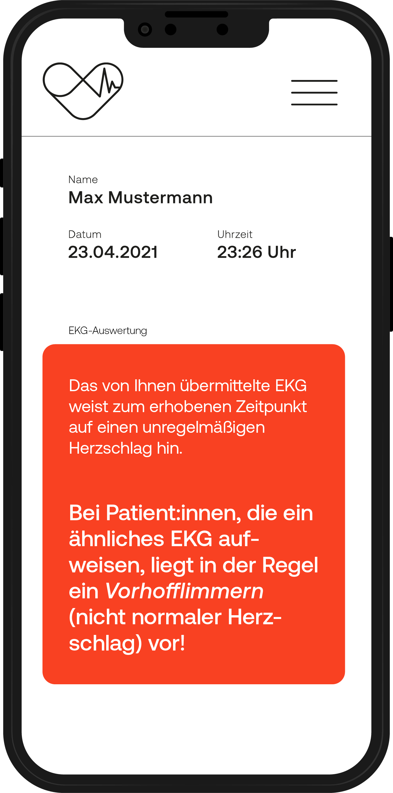 Musterdarstellung einer smartcor-Rückmeldung auf ein eingesandtes EKG, dass Vorhofflimmern vorliegt